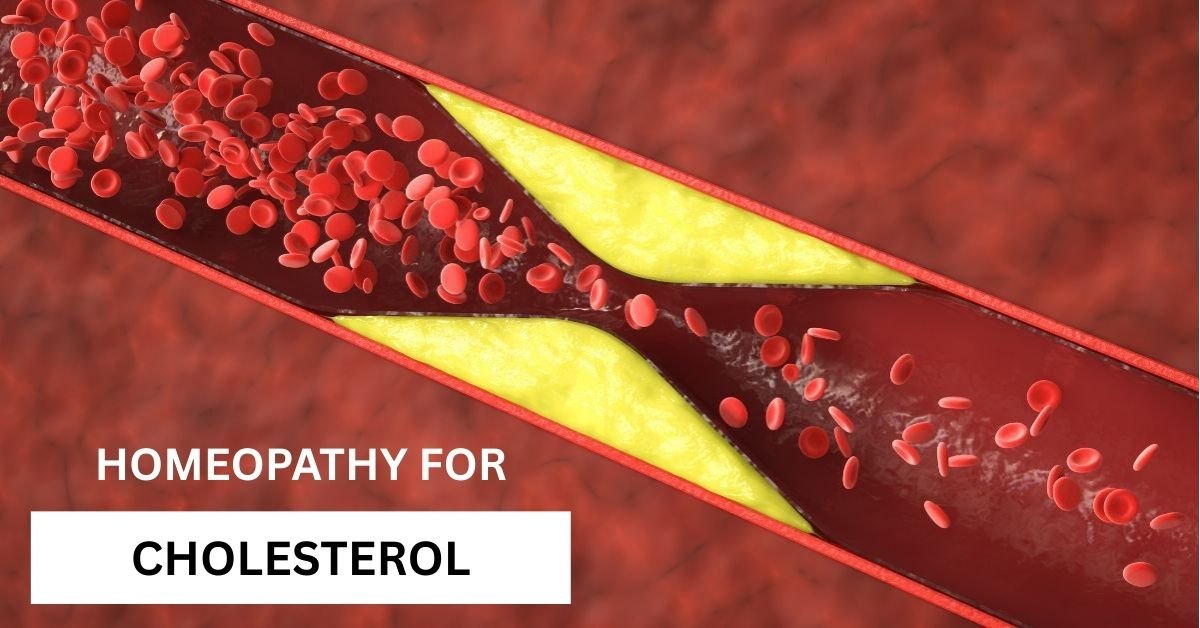 homeopathic medicines for cholesterol