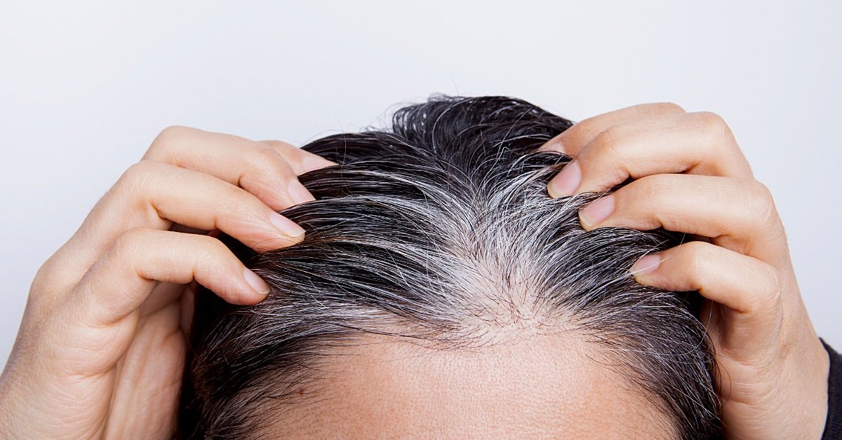 homeopathy medicine for white hair
