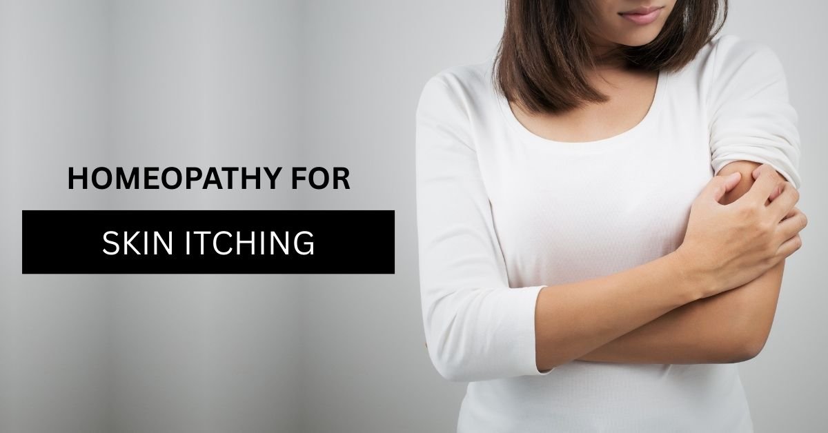 homeopathic medicines for skin itching