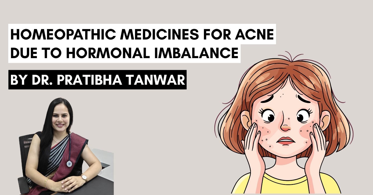 homeopathic medicines for acne due to hormonal imbalance
